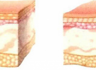 Sinh lý làn da của trẻ sơ sinh và trẻ nhỏ Sinh lý làn da của trẻ sơ sinh và trẻ nhỏ