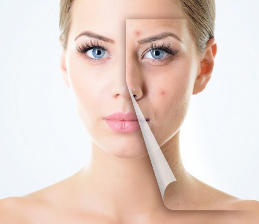 BÍ QUYẾT CHĂM SÓC DA SAU MỤN MÀ BẠN NÊN BIẾT