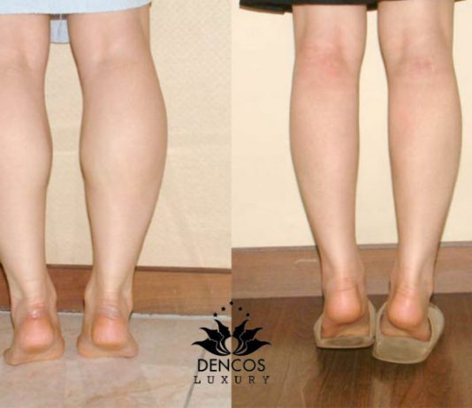 Những sai lầm khi luyện tập khiến bắp chân càng ngày càng to
