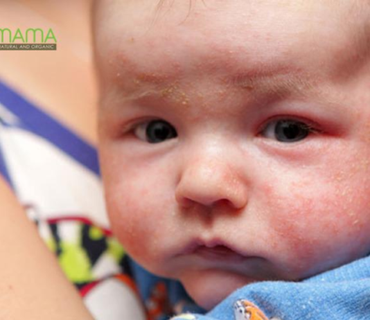 Mua kem chống nẻ cho bé loại nào tốt?