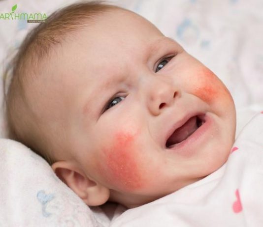 Tại sao chữa hoài da bé vẫn khô?